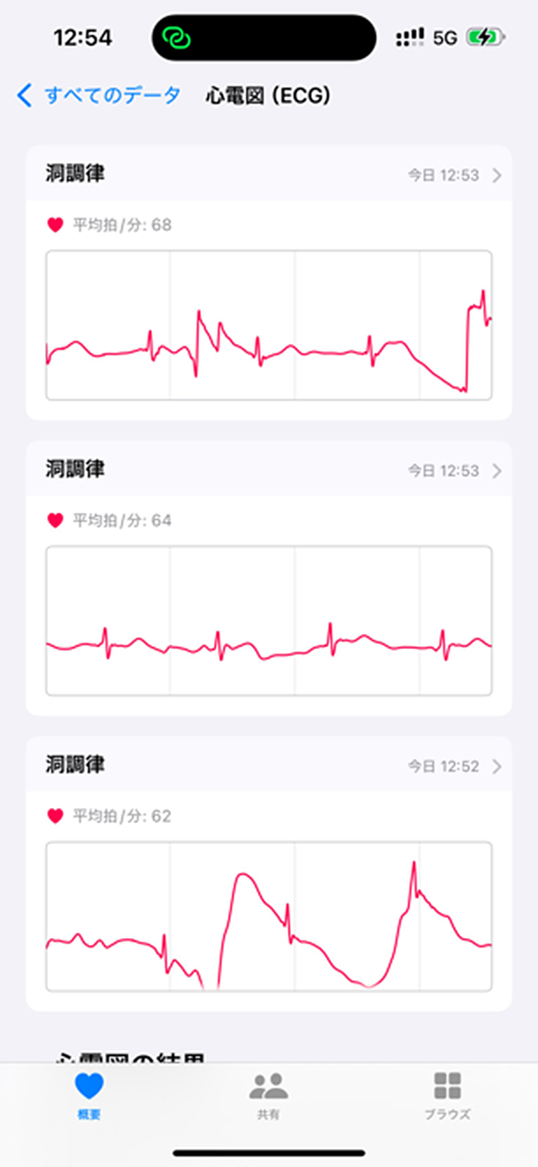 アップルウオッチ