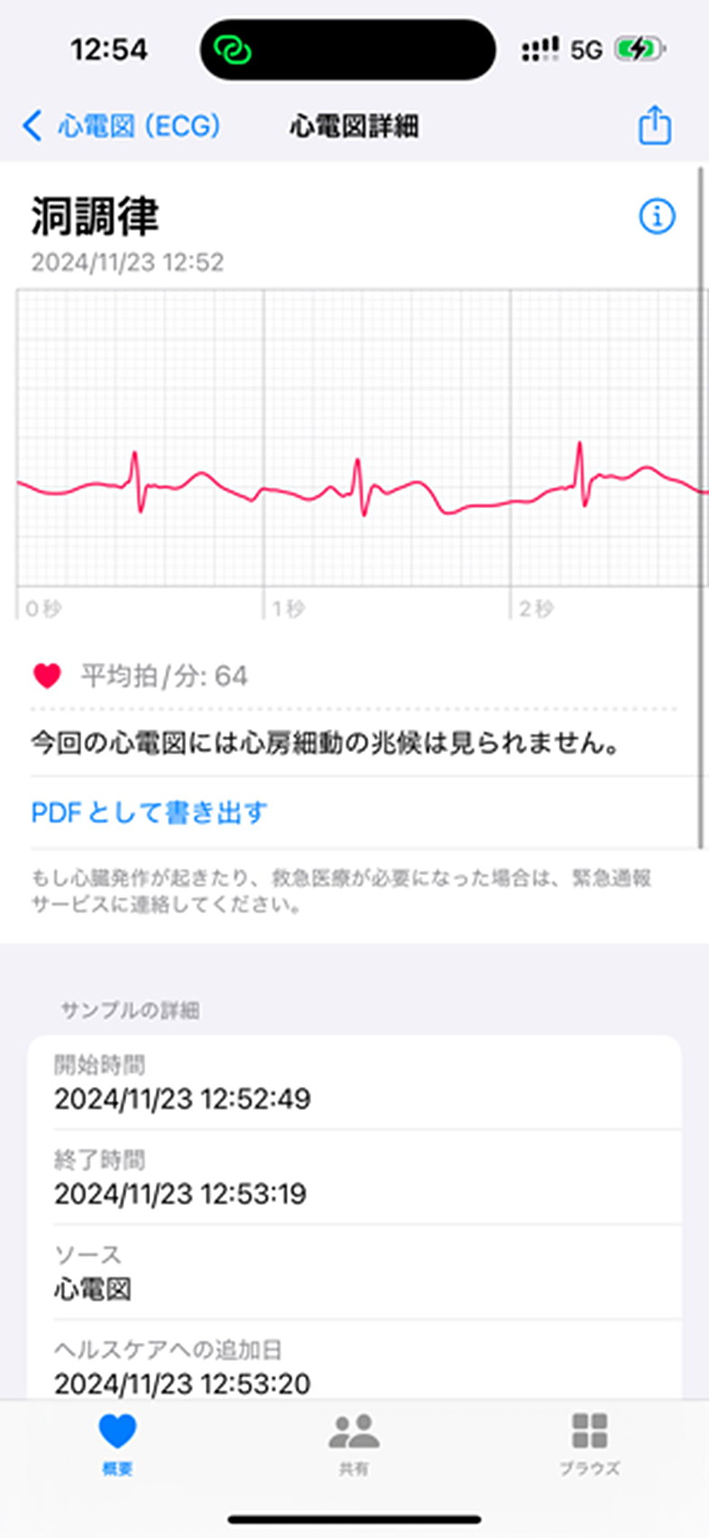 アップルウオッチ